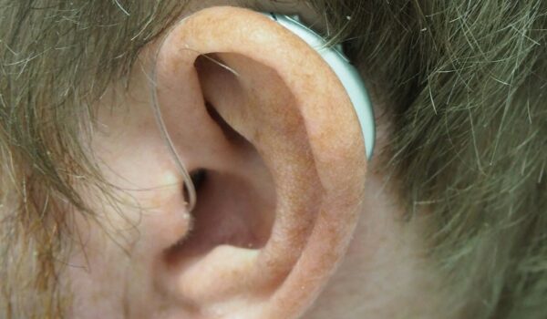 پارگی پرده گوش: علل، علائم، درمان و پیشگیری 1 a close up of a person with a fake ear