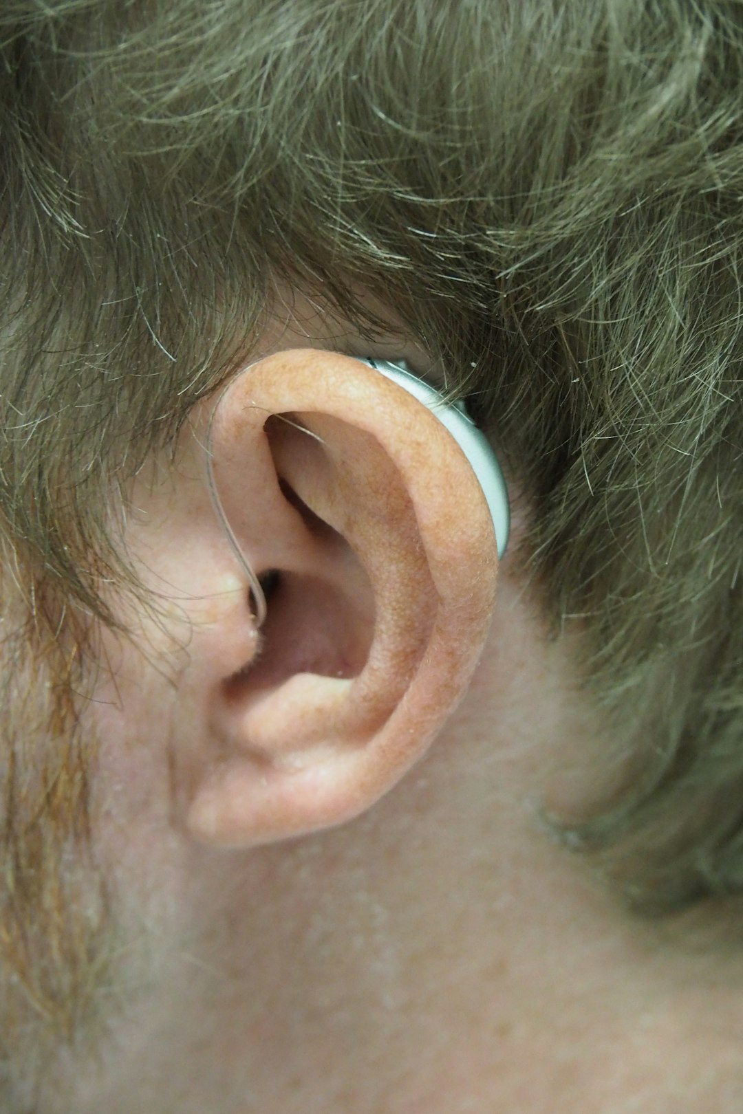 پارگی پرده گوش: علل، علائم، درمان و پیشگیری 1 a close up of a person with a fake ear